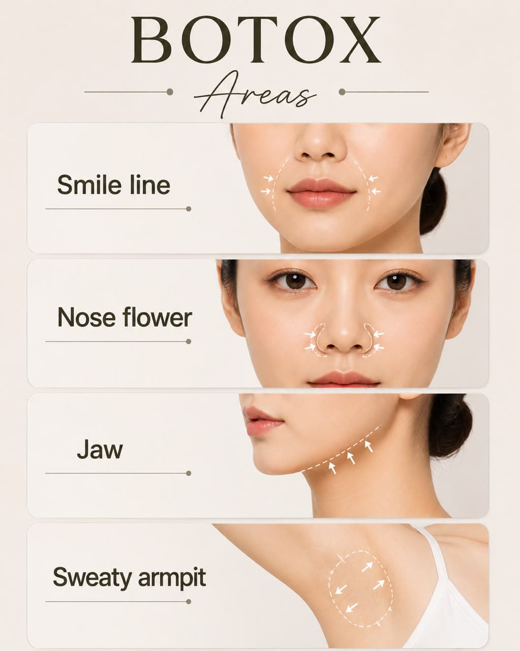 Botox areas — smile line, nose flare, jaw and sweaty armpit
