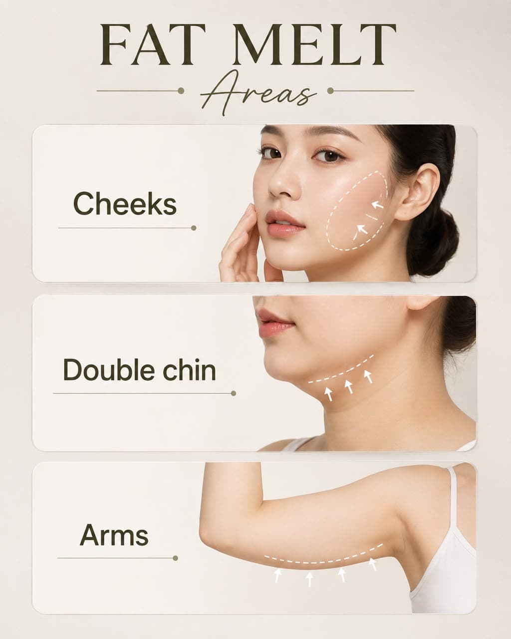 Fat Melt areas — cheeks, double chin and arms