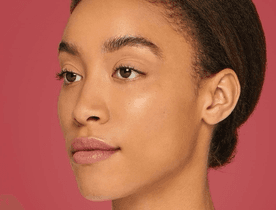 Cheeks after Restylane VOLYME treatment