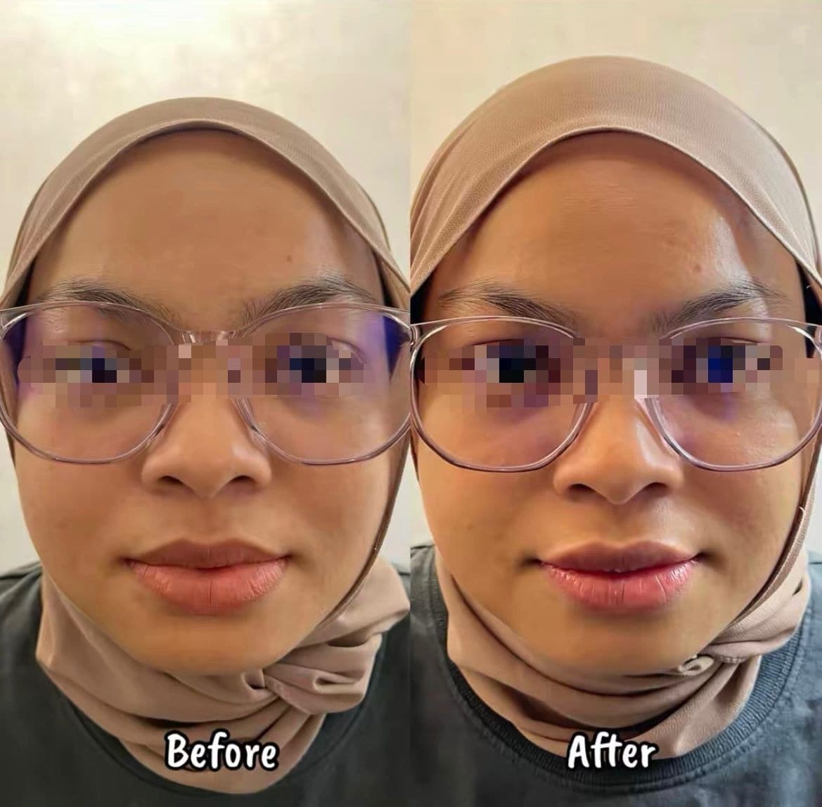 Before and after — brighter, more even skin tone